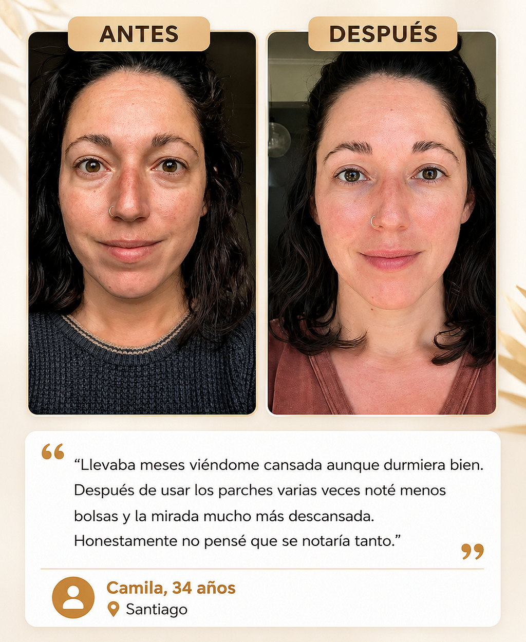 Parches con Microconos para Ojeras, Bolsas y Líneas Finas